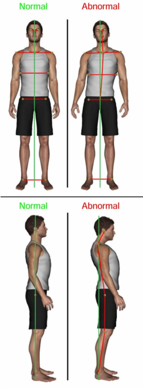 Posture health in Dandenong