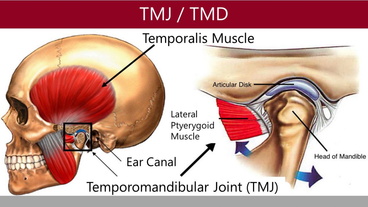 jaw-pain-and-chiropractic-do-you-have-a-tmj-disorder